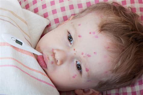 Saving Little Lives: The Tragic Reality of Infant Meningitis